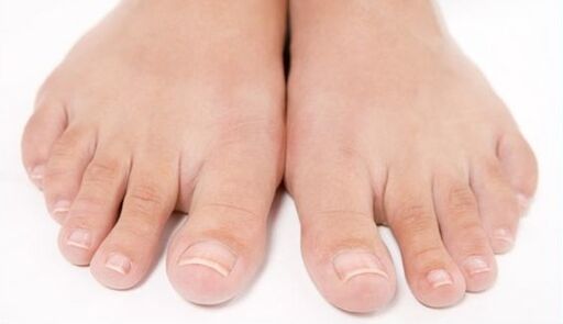 zdrava stopala po zdravljenju z glivicami