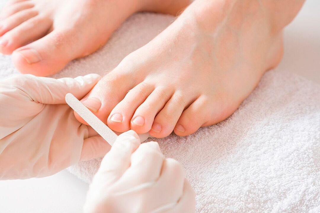 učinkovito zdravljenje glivic na nohtih z laki