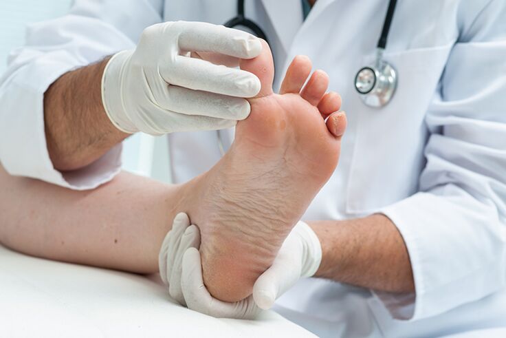 Dermatolog pregleda pacientove noge