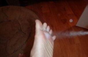 aerosolna obdelava stopala, ki ga je prizadela gliva
